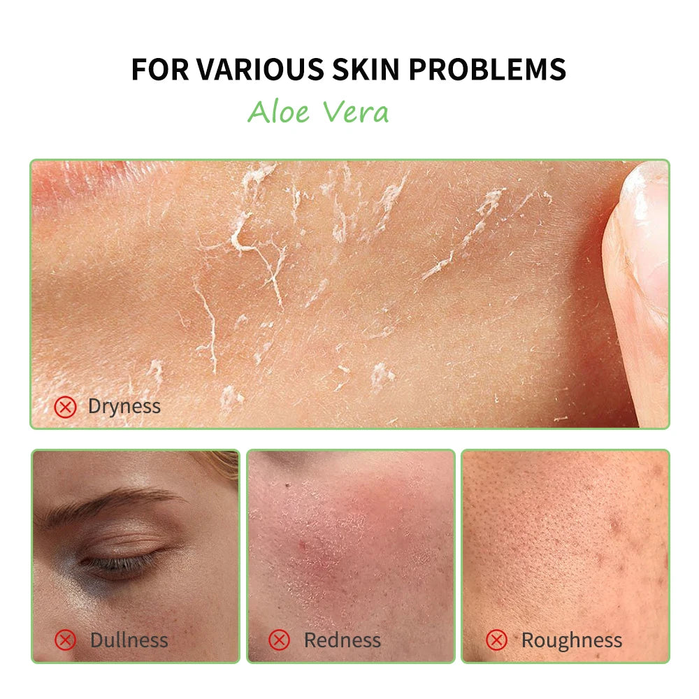 Aloe Vera Hydrating Skincare Set – Cleanser, Toner, Serum, Gel, Eye Cream & Lip Balm